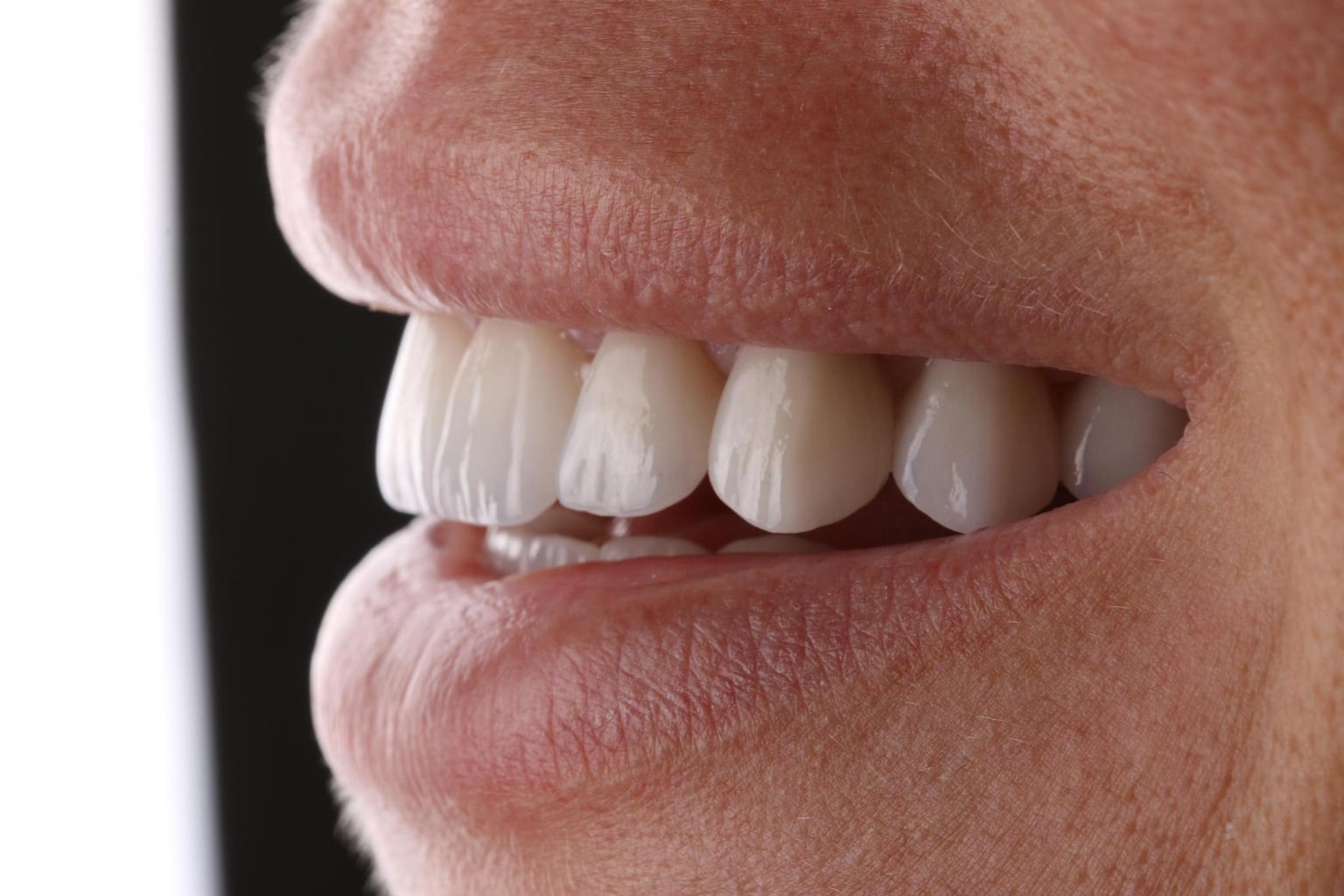 Smile Design