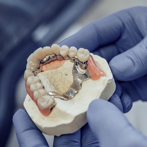 Herausnehmbarer Zahnersatz